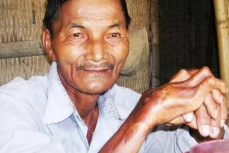 Cerita Unik Thai Ngoc, Pria Vietnam yang Gak Bisa Tidur Selama 50 Tahun!