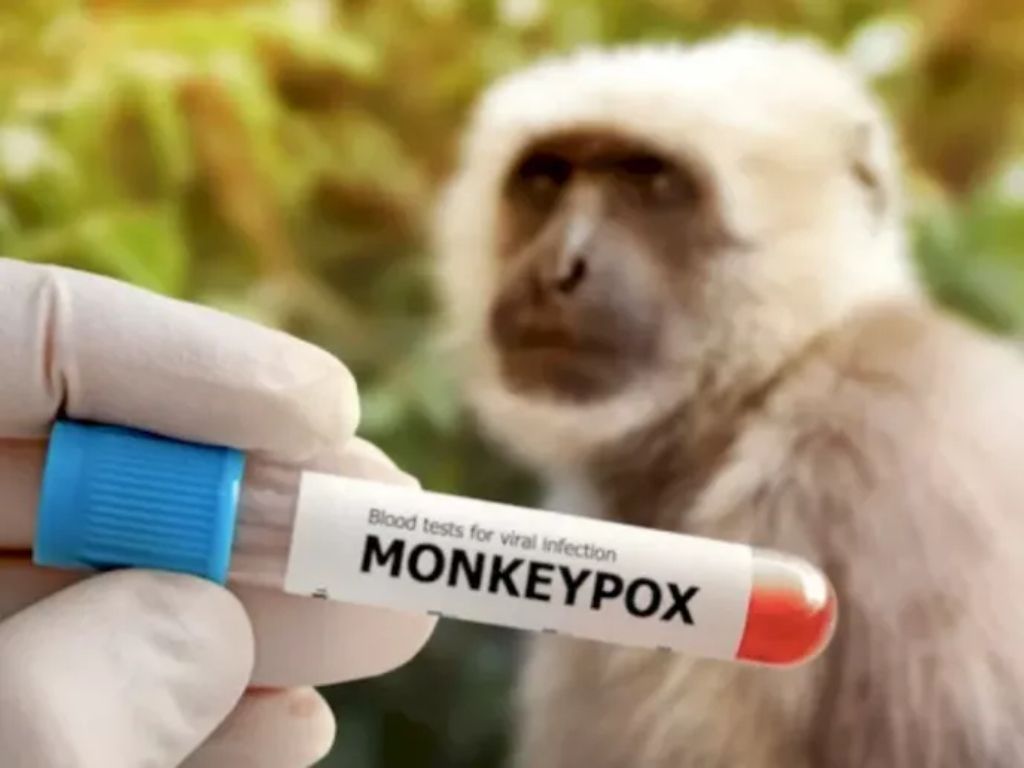 Sejarah Munculnya Mpox: Dari Kasus Pertama hingga Penyebaran Global