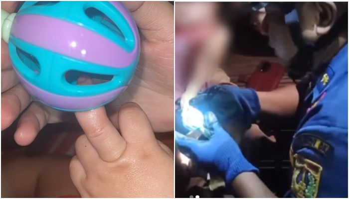 Momen Dramatis Damkar Lepaskan Mainan yang Tersangkut di Jari Bayi, Hela Napas Usai Terlepas