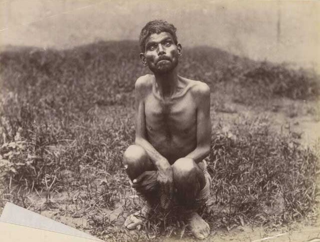 Kisah Misterius Dina Sanichar, Manusia Asal India yang Dibesarkan oleh Serigala