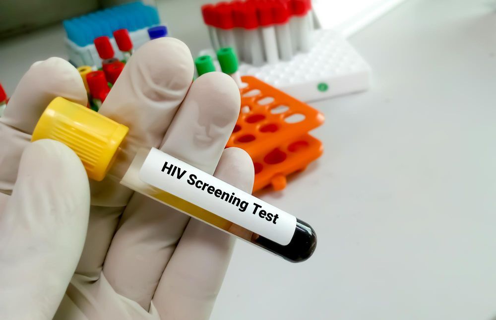 Kasus Penyebaran HIV dan Sifilis Meningkat di Jakarta, Dinkes DKI Gercep Perluas Tes: Ibu Hamil Paling Rentan