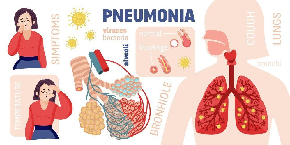 Mematikan, Kenali Tanda, Gejala, dan Cara Mencegah Pneumonia Menuju Indonesia Emas 2045