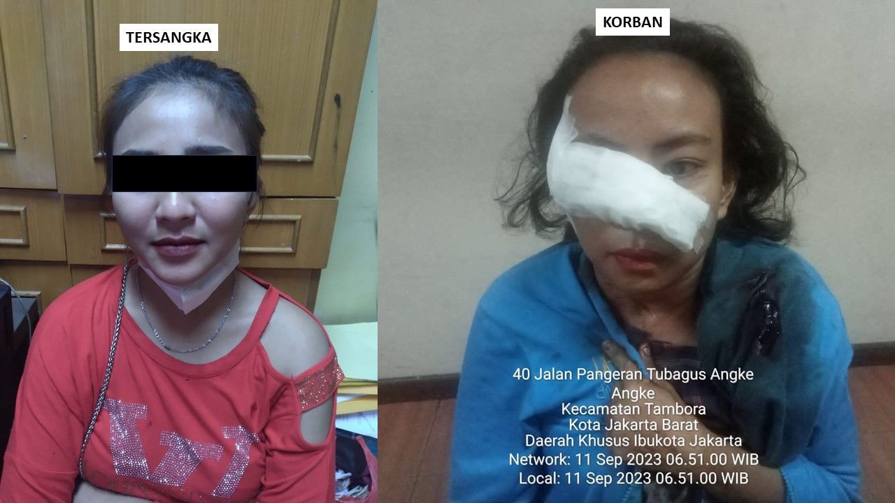 Janda di Jakbar Sayat Wajah Wanita hingga Luka Parah, Motifnya Cemburu