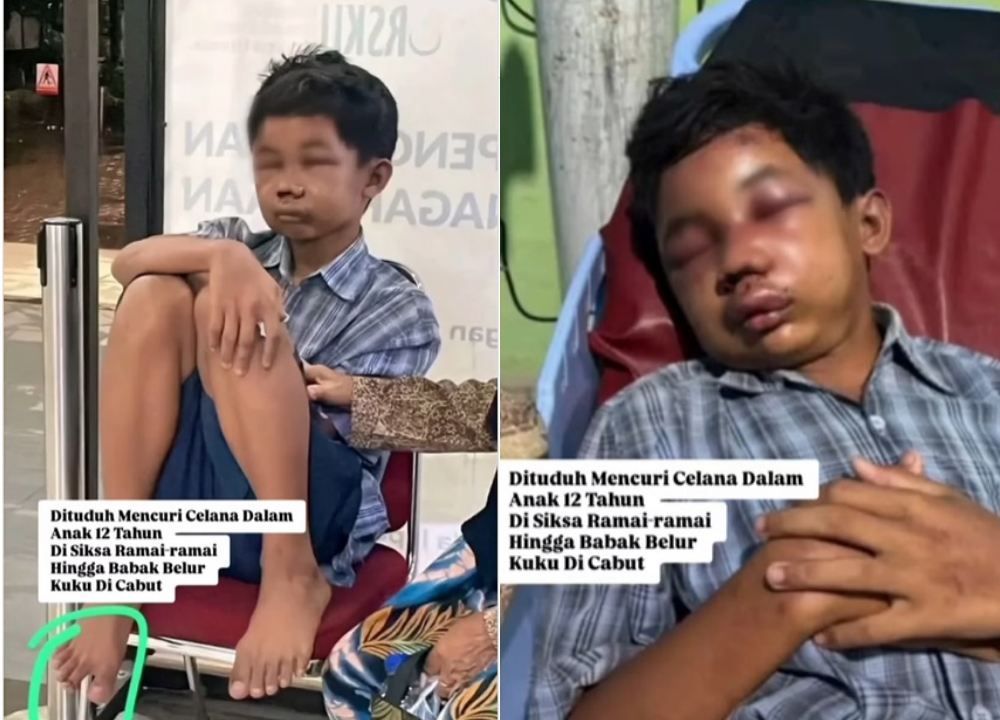 Viral Bocah Babak Belur Usai Dituduh Maling Celana Dalam di Boyolali, 2 Orang Ditangkap Polisi